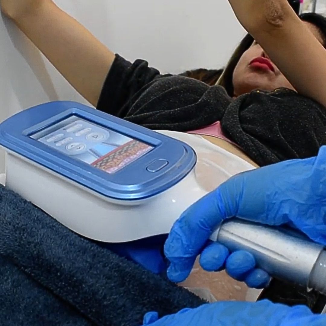 Cryotherapy treatment machine